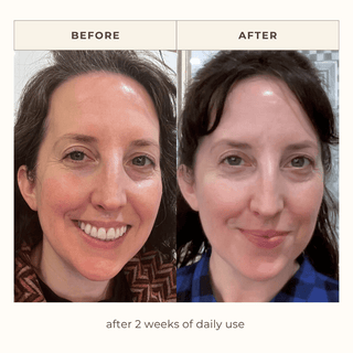 2-week results of daily use