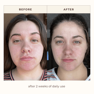 results after 2 weeks.