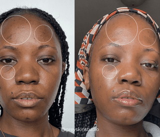 An Apoterra customer's before and after photos showing improved radiance and clarity after use of Apoterra clean skincare products